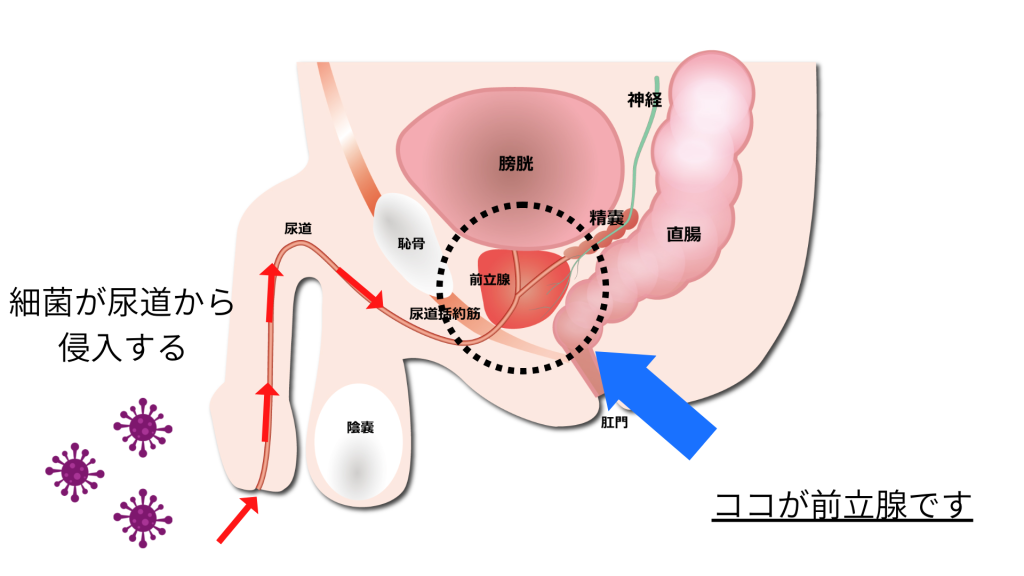 前立腺の病気