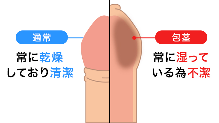 医師監修】ペニスの構造とその役割とは？個人差は？ | メンズライフクリニック【公式】