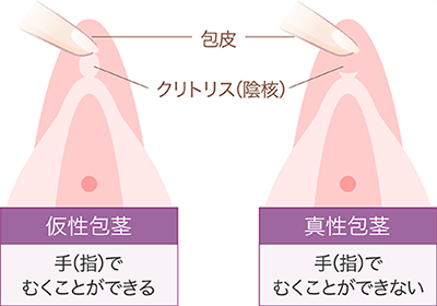 クリトリスの皮の剥き方を画像で解説！自分で剥く・剥いてもらうやり方