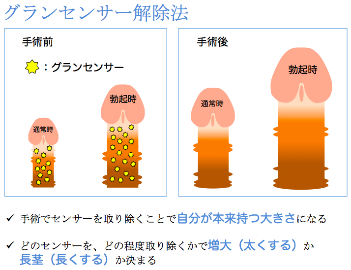 ギネス】世界一でかいちんこは34cm、最も小さいちんこは1.5cm｜あんしん通販コラム