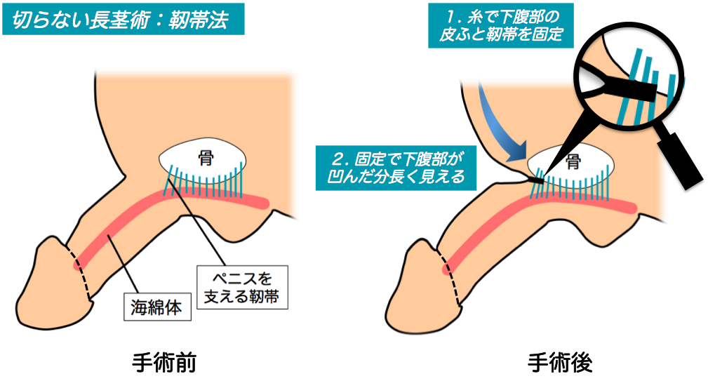 医師監修】ペニスの構造とその役割とは？個人差は？ | メンズライフクリニック【公式】