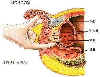 アナルオナニーをするなら前立腺・膀胱・精嚢の位置をイメージせよ | アネドラ