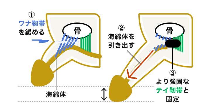 ペニス増大 | HARG(発毛)・AGA・メンズ脱毛・包茎治療ならラミュー・中央クリニック