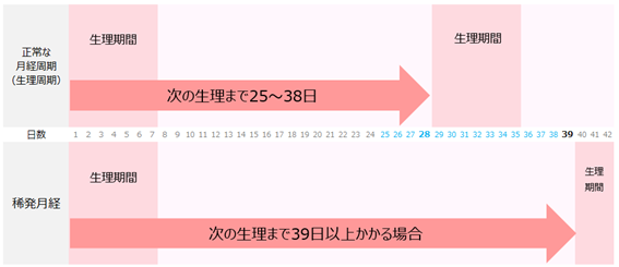 毎朝起きられない | あなたの症状の原因と関連する病気をAIで無料チェック