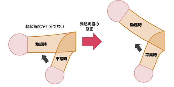 綺麗なちんこの条件はカリ高で軽く上反り | 男性生殖器マニア