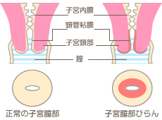 連載〈気になるデリケートな話〉#03「さぁ、お⼿⼊れしましょう」 | SAVVY.jp |