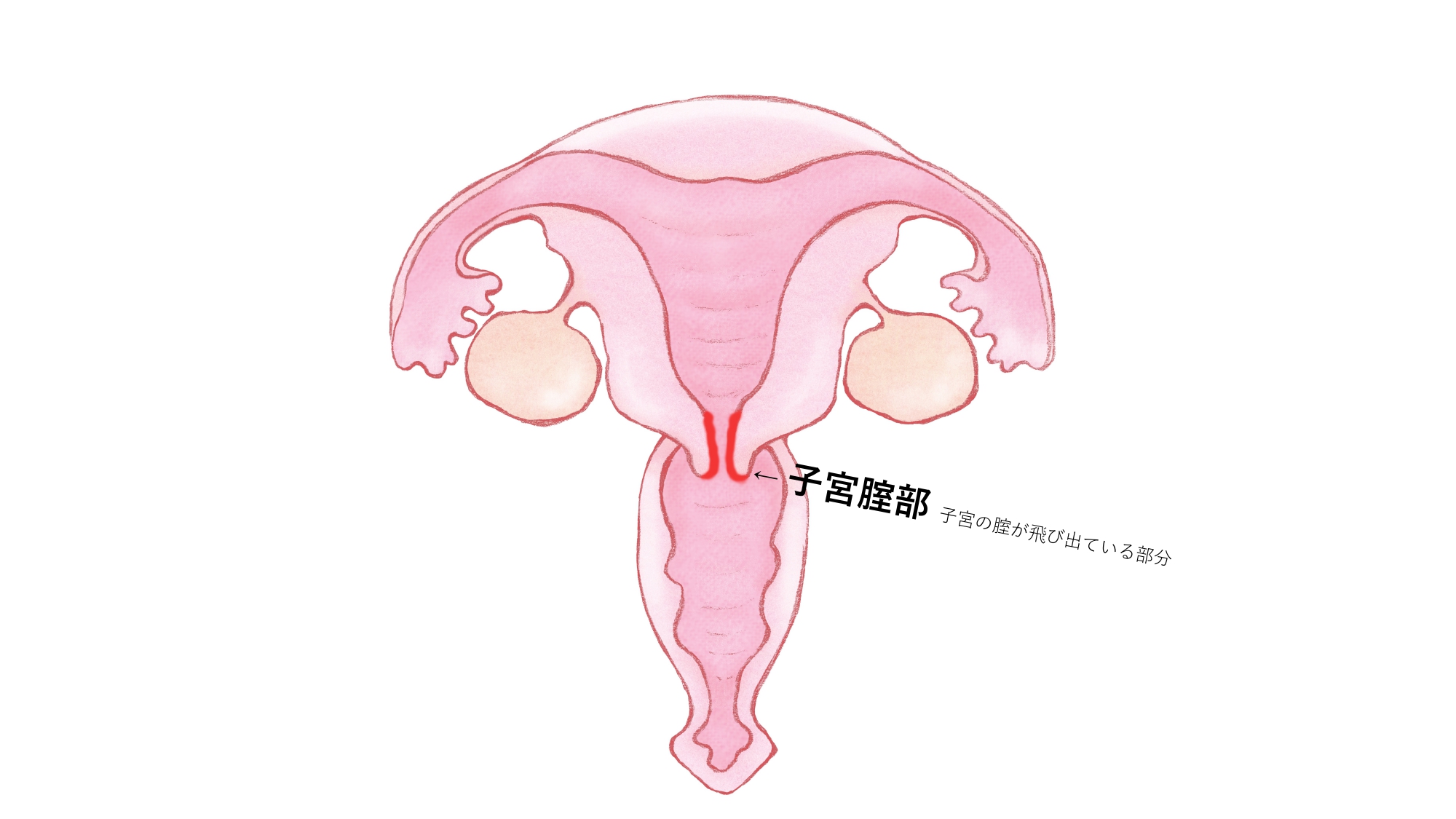 膣・感度ーサンライズ美容外科