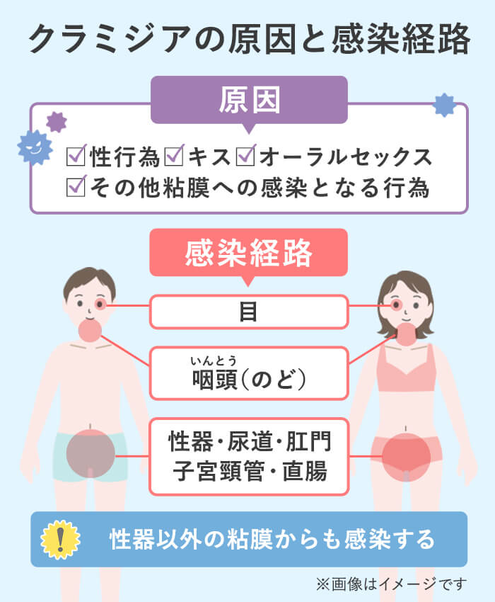 扁桃炎と性病の見分け方とは？咽頭（のど）に感染する？