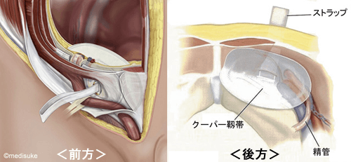 恥骨が出てる骨盤を放っておく事による4つの恐怖 - 小顔矯正・整体を東京でお探しならRevision