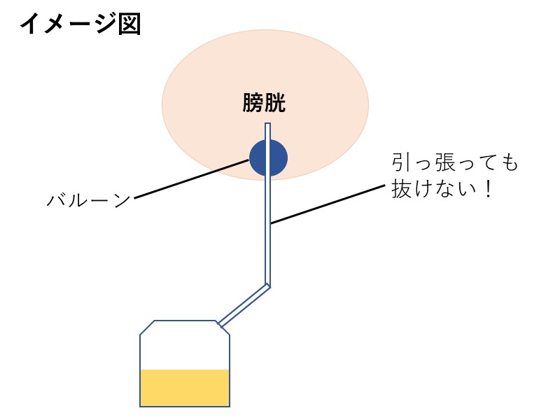 ゲイ動画】尿道カテーテル責め、アナル特大ディルド責め、オラオラ言葉責めに法悦感が止まらないド変態筋肉イケメン！ |  無修正無料ゲイ動画・ビデオ｜G-MENS