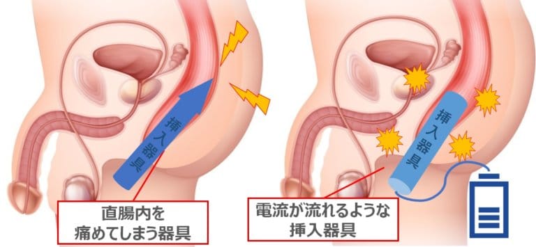 メスイキ｜メスイキ方法｜男のメスイキ｜ドライオーガズム～信長トイズまとめブログ