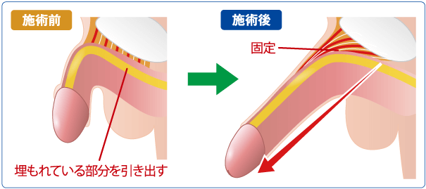 平常時のちんこを大きくする方法】小さいペニスをデカく見せる秘訣 | 男の美学