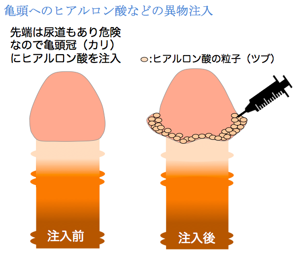 勃起力の維持方法と朝勃ち（朝立ち）を解説〜勃起は、すればするほど健康に良い！？〜 - TENGAヘルスケア プロダクトサイト