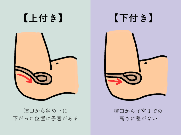 名器とは？その種類や特徴と名器を作る名器形成について | コラム一覧｜ 東京の婦人科形成・小陰唇縮小・婦人科形成（女性器 形成）・包茎手術・膣ヒアルロン酸クリニック