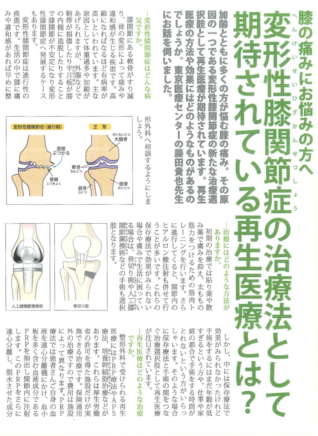 腰椎すべり症の治療について | 岡山済生会総合病院