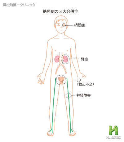 勃起とは？勃起の仕組みと勃起力低下の原因と対策を解説 - 藤東クリニックお悩みコラム