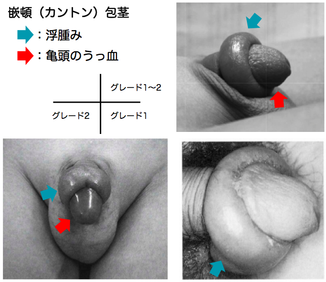 セクシーなお*系のタケルのおちんちんは真性包茎！ FC2-PPV-2660594