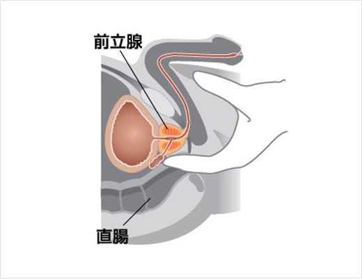 前立腺の病気 | やまだ泌尿器科クリニック