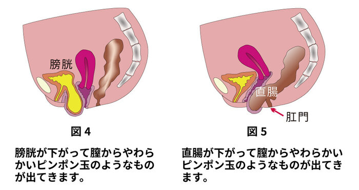 恥骨痛の原因と対策｜川崎市高津区高津整体院