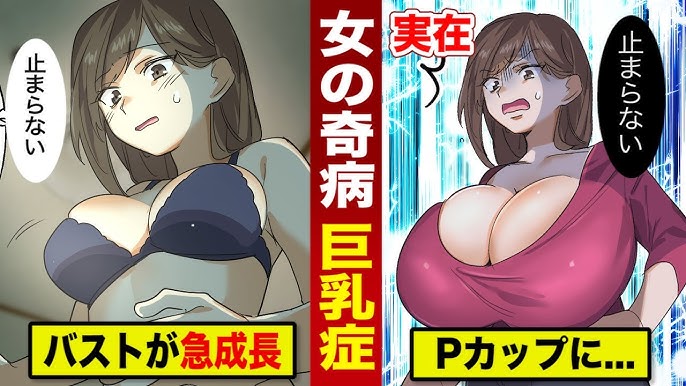 34ZZZの「超乳」から33キロもの組織を切除した24歳の女性―マケドニア | HEAVEN