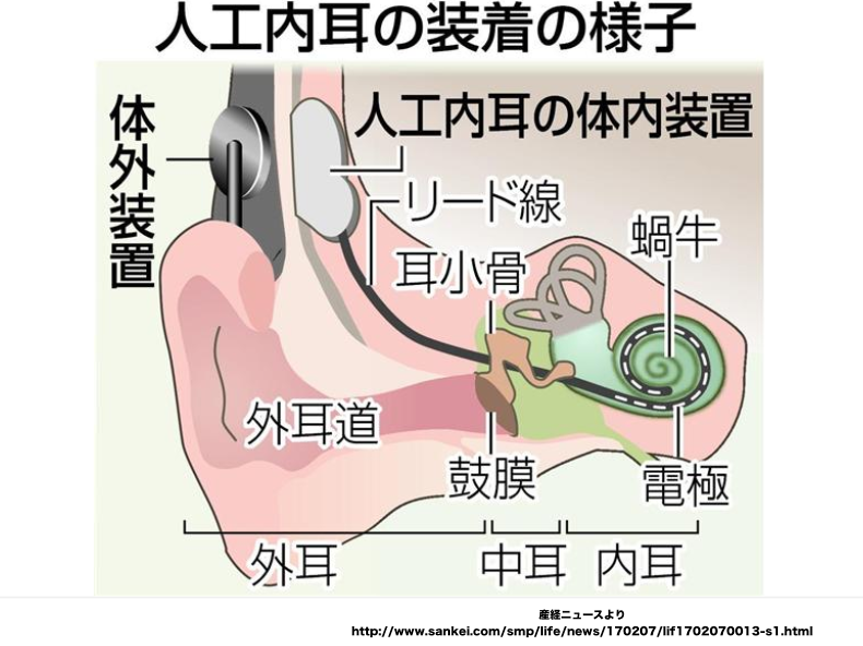 楽天市場 手元スピーカー 有線 5m 音がクッキリきこえる君 テレビの音 聞こえる 収音器 集音器 貼るだけ 耳元スピーカー 電池式 テレビスピーカー音量 TV オーディオ 便利グッズ 家電 介護 母の日 父の日 騒音対策 敬老の日 送料無料 送料込 60N◇ 音がクッキリきこえる