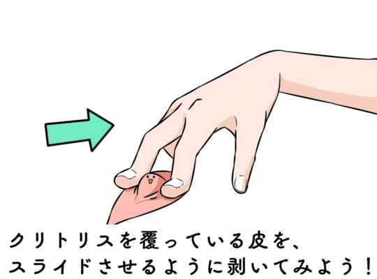 クリトリス(陰核)包茎｜美容外科・美容整形なら宮崎・大分・東京の経験豊富なコムロクリニック