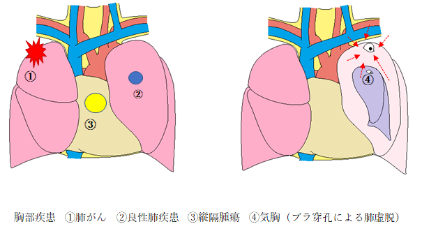 山梨県立中央病院 – 情熱医療プロフェッショナルドクター