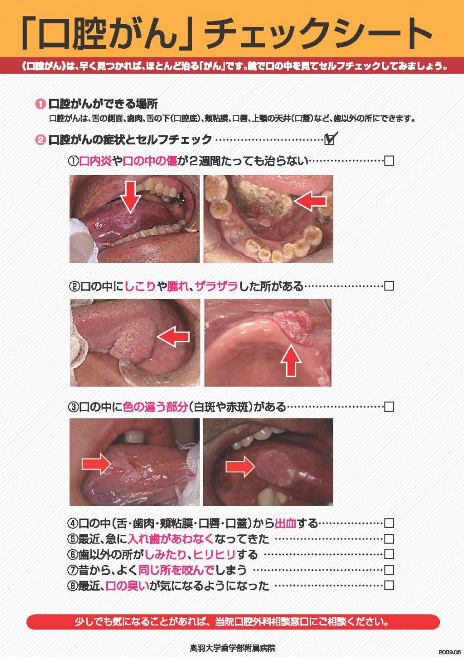 ポルチオとは？産婦人科専門医の丹羽咲江医師が子宮腟部を徹底解説します。 | 腟ペディア