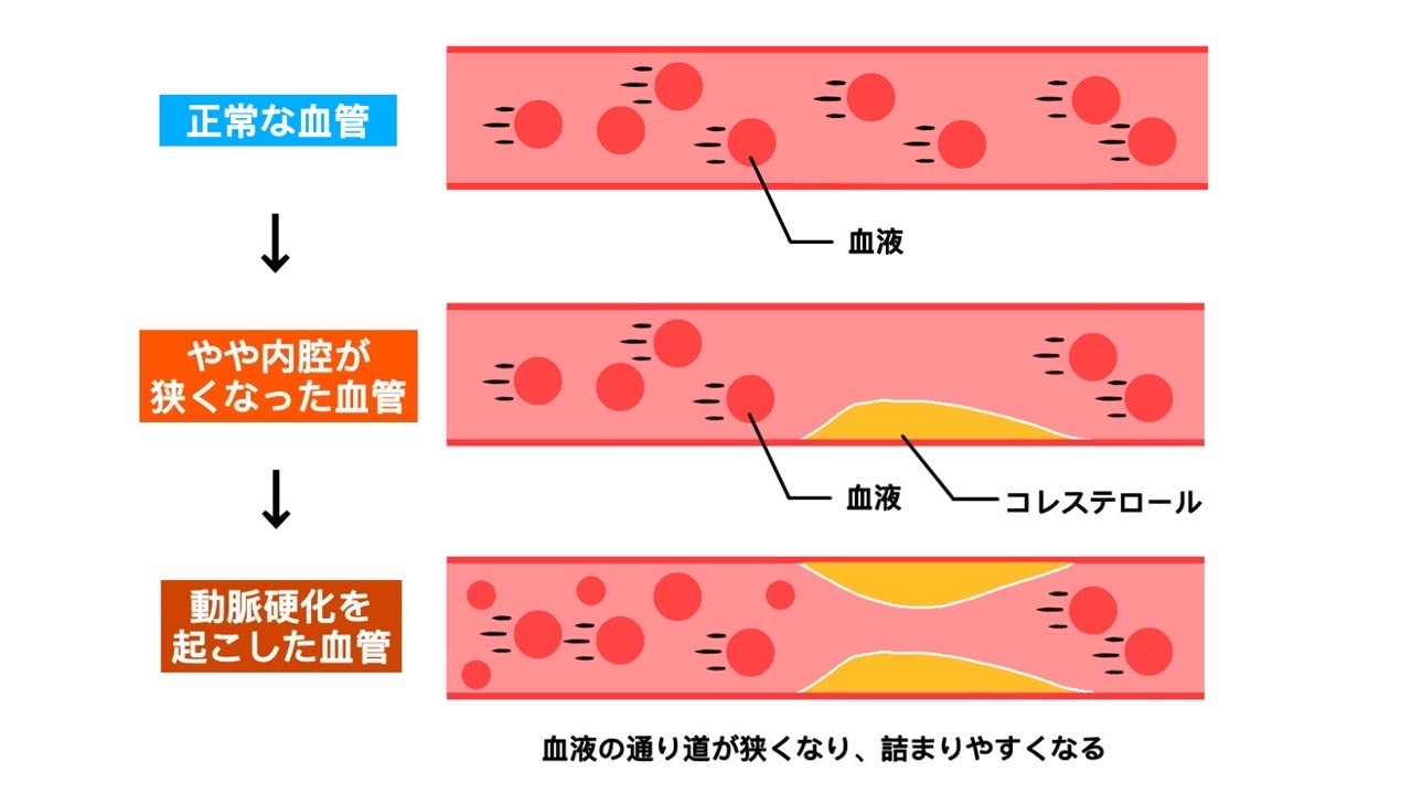 トイレのつまりをDIYで修理する方法と費用相場 | リフォーム・修理なら【リフォマ】