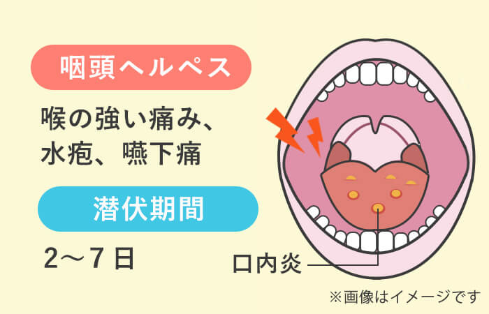 トリップスキンとは？生フェラとの違いや使い方を徹底解説！ | はじ風ブログ