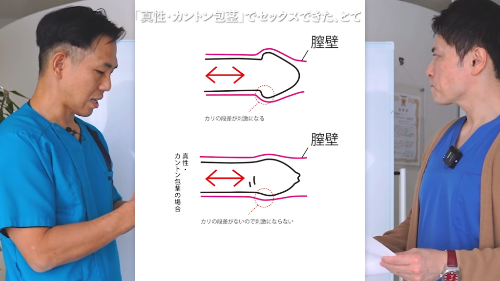 押すだけでイキ狂う!?悪魔の性感帯”会陰”って知ってる？｜BLニュース ちるちる