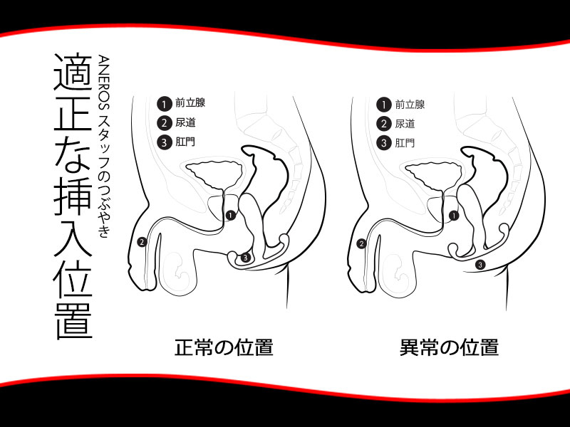 前立腺マッサージとはどんなプレイ？ 風俗エステ嬢がやり方を詳細解説 | シンデレラグループ公式サイト