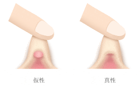 クリトリスの剥き方を詳しく紹介！正しい手順や注意点を解説｜風じゃマガジン