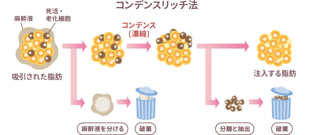 市民病院医療事故多発》「膿出し切る必要」現役医師が提言 - Yahoo!