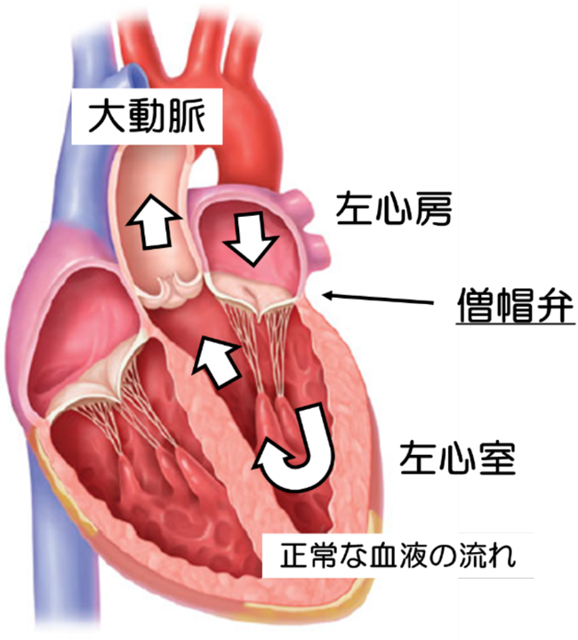 小児鼠径ヘルニアの手術治療 | メディカルノート