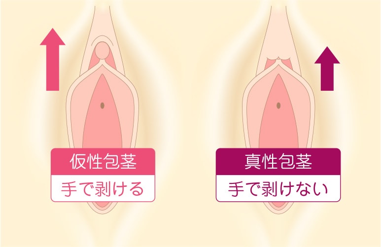 クリトリスの触り方！クリ愛撫でのいじり方 - 夜の保健室