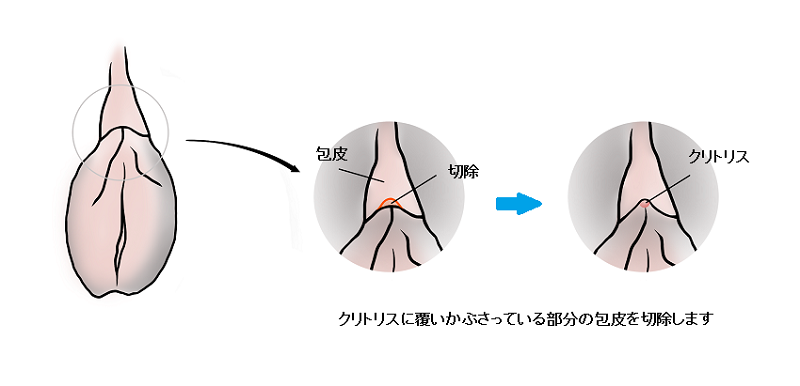 クリトリスは快感を得るための臓器であることを知っていましたか？