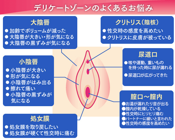 婦人科・女性器形成 | 診療内容