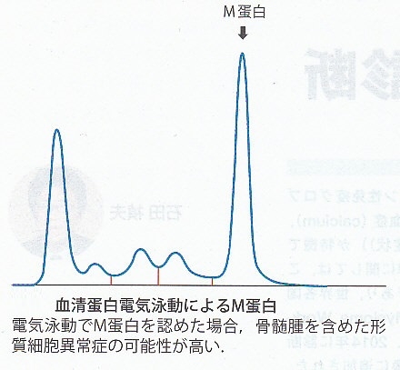 生活とがんと私 Vol.16 石川