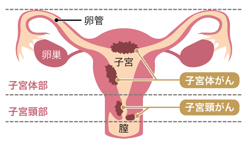 医師監修📝 妊活用語辞典：「子宮卵管造影検査（しきゅうらんかんぞうえいけんさ）」とは？ 】 こんにちは。