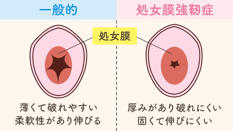 あそこの大きさの秘密！男性の身長とペニスのサイズの関係/ラブナイト【恋本コラム】