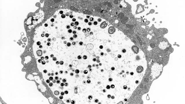 フェラで喉が性病になるって知ってる？ 感染する病気の種類とその防ぎ方