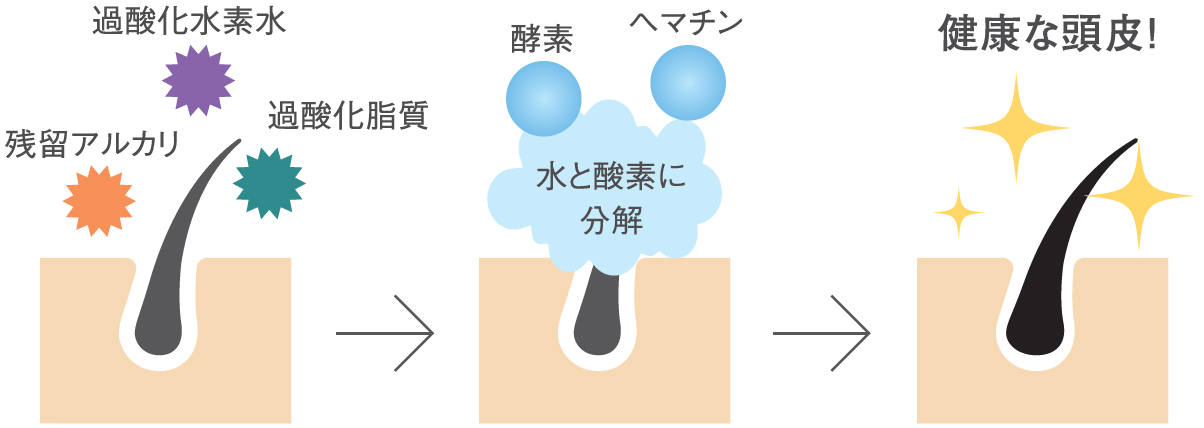 予防医学の観点からつくられた頭皮の酸化・糖化・炎症を抑える抗老化ローション ITNA GIO(イッタナジオ)とは？ |