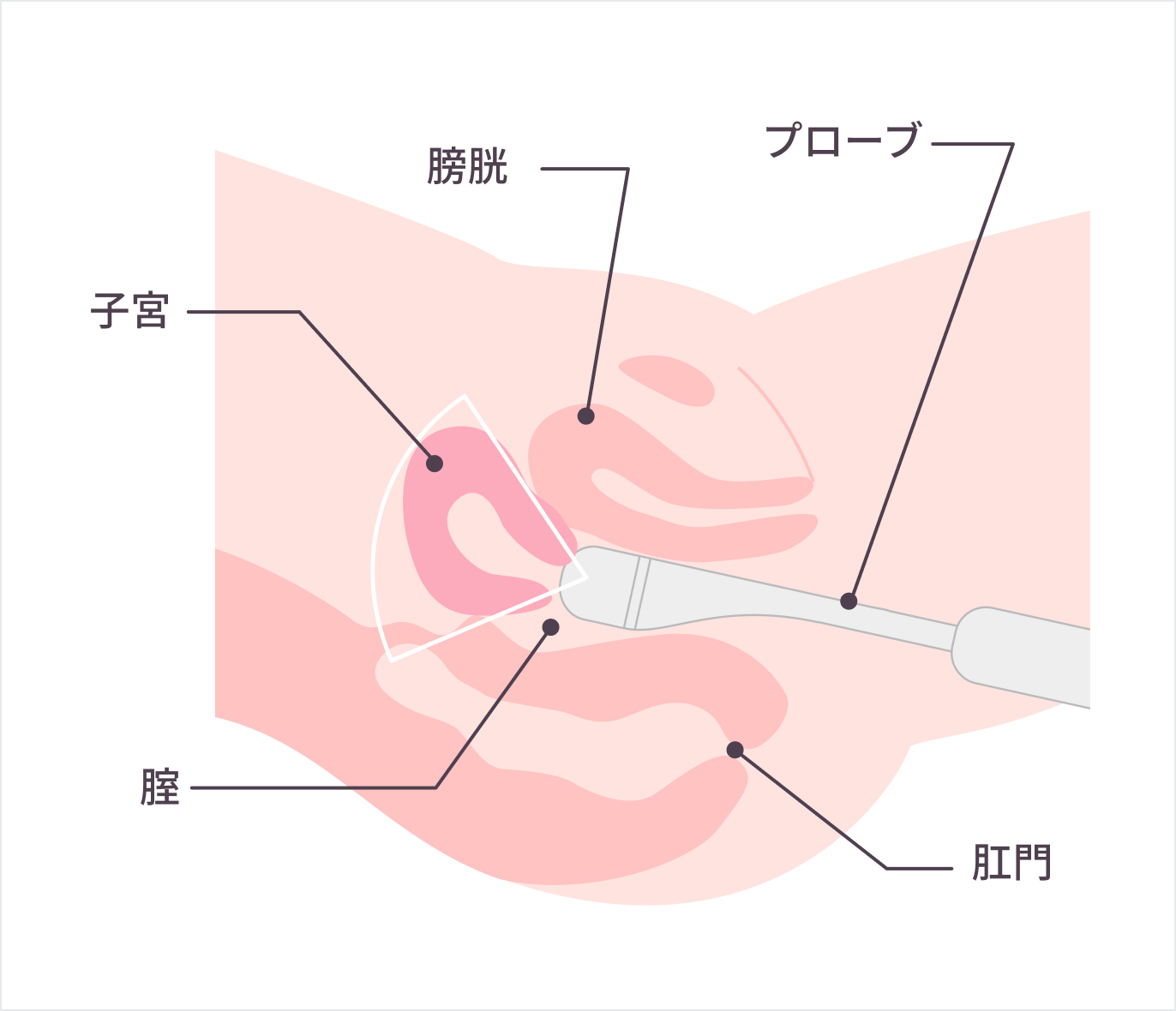 アナルセックス危険性 肛門にも性病感染する？|天神マイケアクリニック