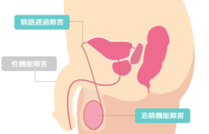 無精子症 | 長崎県初！漢方薬&不妊鍼灸&美容鍼灸&耳つぼダイエット専門院の佐世保はり灸大丸健康院