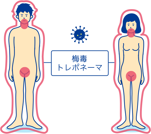 知らないうちに感染してるかも?オーラルセックスで感染するSTD(性感染症)｜2013年7月の特集｜性感染症の検査を、より身近なものに STD研究所