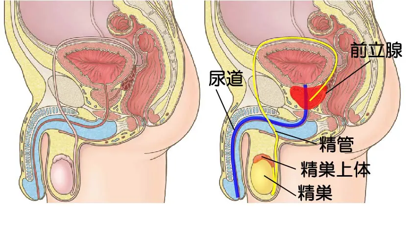 経尿道的前立腺切除術 | 泌尿器科 |