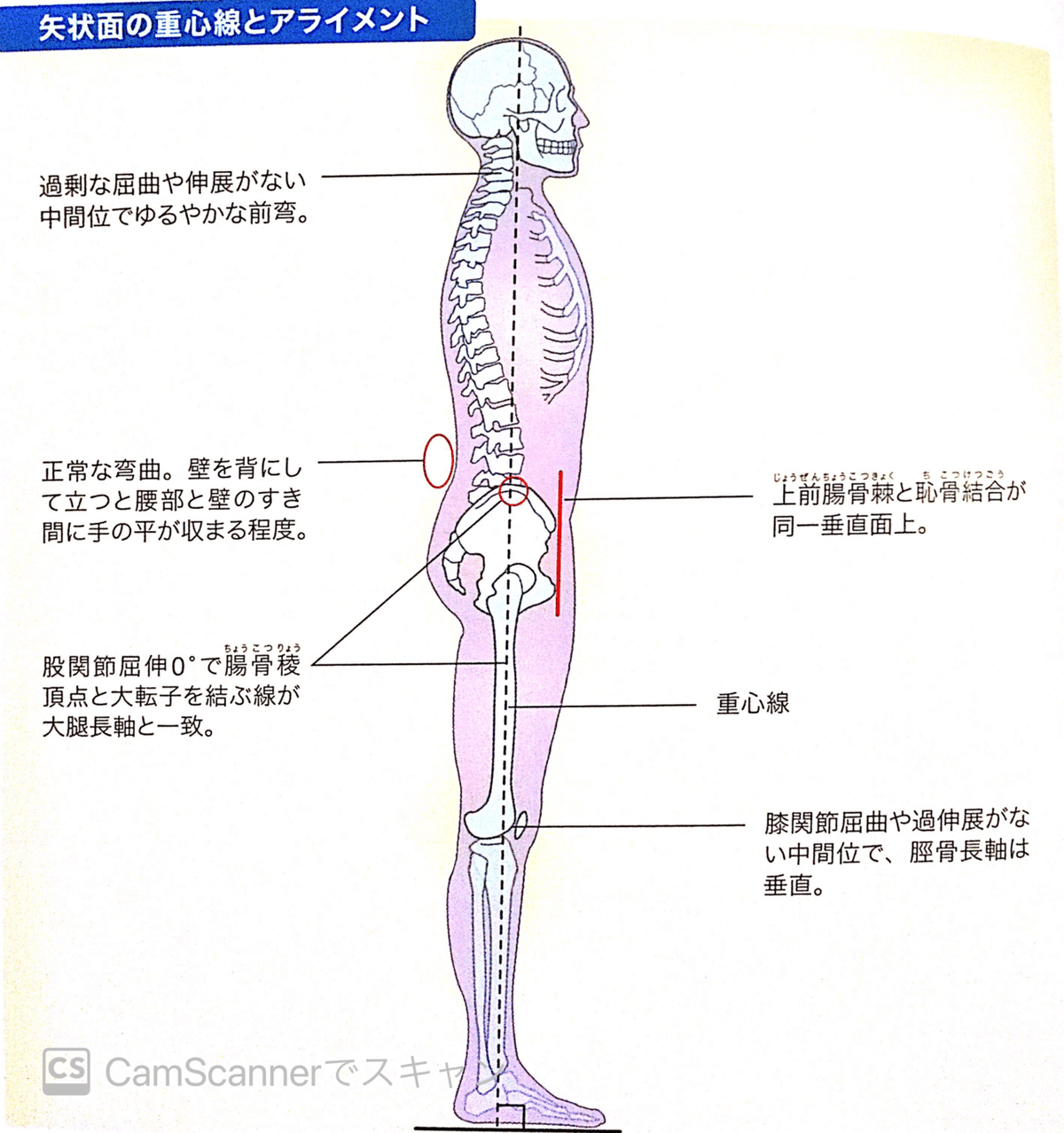 臼蓋形成不全 (きゅうがいけいせいふぜん)とは |