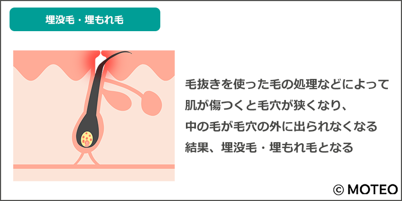 楽天市場】ヒゲ 薄く クリームの通販