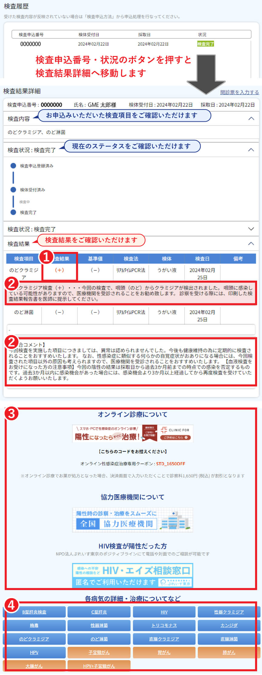 性病検査キット（郵送）クラミジア・梅毒・HIVなど自宅で簡単検査 GME医学検査研究所